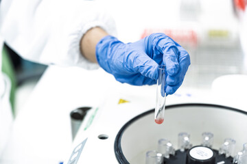 Scientist hand wear blue gloves holding glass blood test tube and reagent into the centrifuge for...