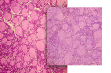 Detailed microscopic view of tissue, exhibiting  a marbled pattern.  Pink,  lilac, and beige tones.  Two sections