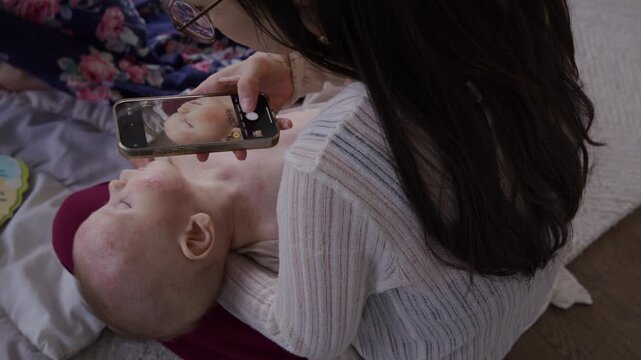 Mother takes photos on phone of infant with eczema while he sleeps in her arms