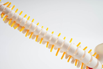 Spinal nerve and bone, Lumbar spine displaced herniated disc fragment, Model for treatment medical...