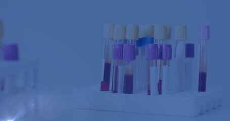 Presenting plastic test tube rack holding colored blood tubes on lab bench, with blurred equipment