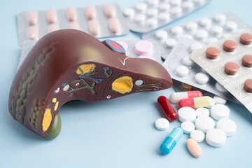 Liver model with pill drug treatment, Cirrhosis, Liver cancer, fatty liver.