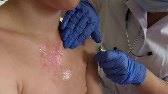 The child's skin shows signs of an allergic rash during the examination.