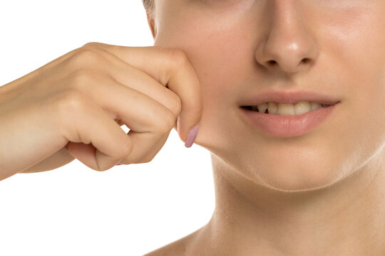 Studio shot closeup of young woman stretching cheek skin with fingers on white background.