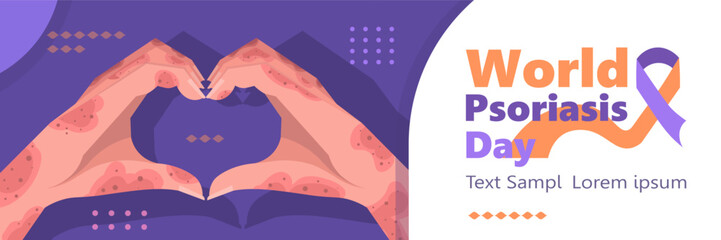 World Psoriasis Day is observed every year on October. Banner with two hands with skin issues making a heart gesture. Vector Not AI generated
