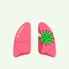 Fototapeta premium Illustration of a virus impacting the human respiratory system with focus on lung damage and infection spread within the pulmonary organ