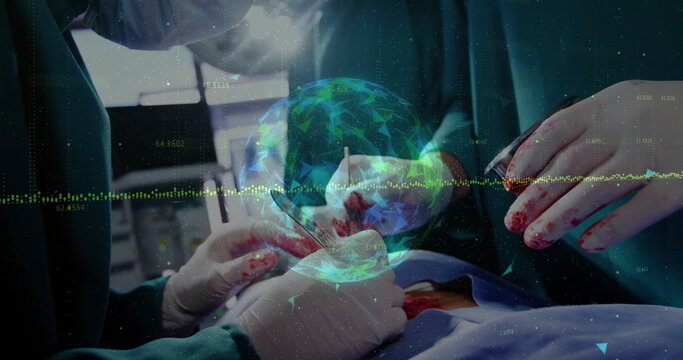 Gloved surgeons in gowns making incision in operating room, with globe hologram waveform overlay