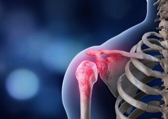 Shoulder joint pain highlighted in red