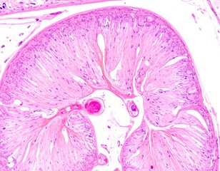 Microscopic view of stained tissue section, showing complex structures and cellular patterns