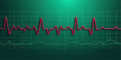 The EKG graph on a medical monitor shows a strong heartbeat, illustrating a healthy pulse