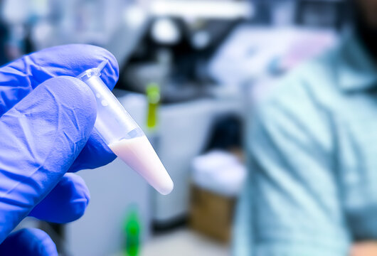 Scientist or Biochemist holding Eppendorf with Lipemic blood sample. High Triglyceride contain blood sample. Lipid profile