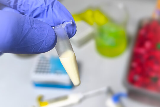 Scientist or Biochemist holding Eppendorf with Lipemic blood sample. High Triglyceride contain blood sample. Lipid profile