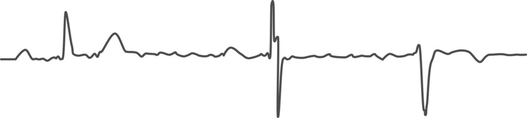 High-quality ECG trace showcases clear heartbeat pattern, ideal for medical, health, and science-related projects, for educational or professional use