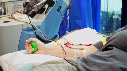Stem Cell Donation with Donor Squeezing Ball During Apheresis Procedure or blood donation. Tubes carrying blood to the machine are visible from the side view, illustrating blood cancer treatment.