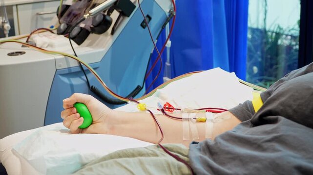 Stem Cell Donation with Donor Squeezing Ball During Apheresis Procedure or blood donation. Tubes carrying blood to the machine are visible from the side view, illustrating blood cancer treatment. 