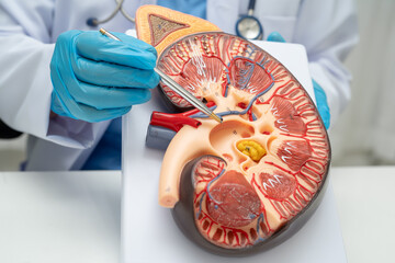 Chronic kidney disease, doctor with model for treatment urinary system, urology, Estimated...
