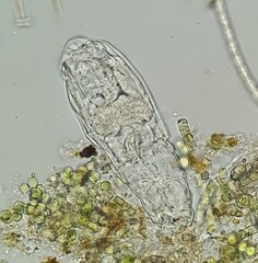 500x, NA 0.75
Brightfield micrograph of bdelloid rotifer at 500x magnification, NA 0.75
