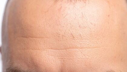 Closeup of Human Forehead Skin Texture with Fine Lines and Pores