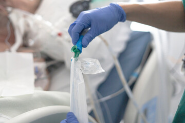 Doctor inflating endotracheal tube cuff in hospital setting