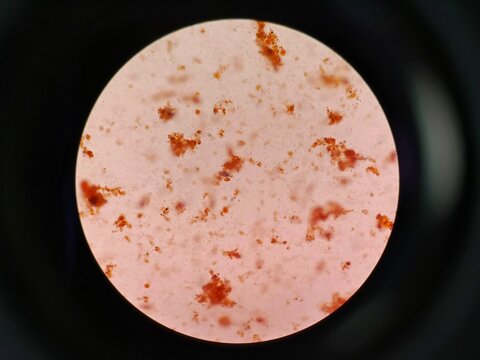 Microscopic view of Giardia lamblia (Giardia intestinalis) parasites in a human fecal sample. 