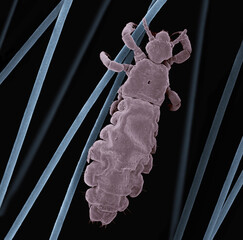 SEM images of head lice (Pediculus humanus capitis) on hair
