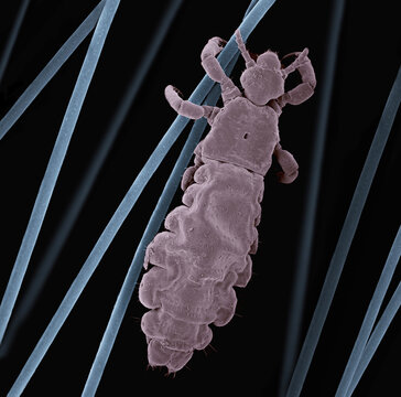 SEM images of head lice (Pediculus humanus capitis) on hair