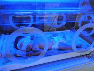 Newborn in incubator under blue light for neonatal care in hospital setting