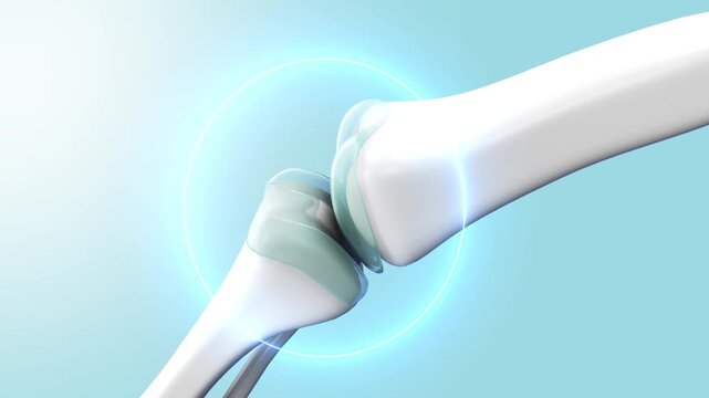 Treatment of knee pain and cartilage protection 3D collagen augmentation in the knee joint