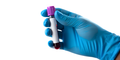 Gloved hand holding blood sample vial with red liquid for laboratory testing and medical diagnostics concept