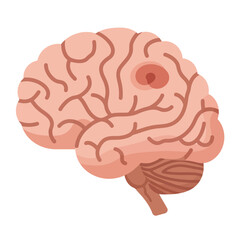 brain damage illustration showing tumor growth for medical education content and healthcare awareness campaign materials