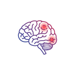 human brain inflammation causing neurological disorders affecting cognitive functions shown for medical visuals