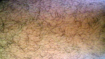 Close Up of Hairy Human Skin Texture