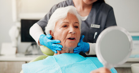 Dental, senior woman and mirror with results for teeth whitening, gum disease and dentures....