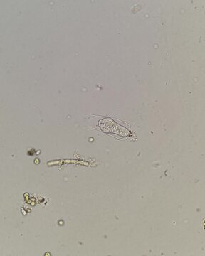 Brightfield video of Cothurnia annulata ciliate at 200x magnification
