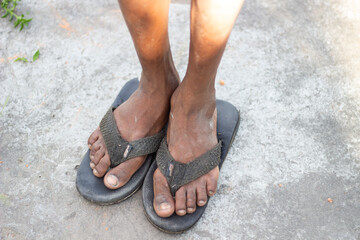 Closeup view of a persons feet wearing wornout flipflops