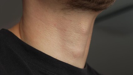 Adam's apple on a male body.
Movement of the Adam's apple during swallowing.
Male body parts and sexual differences.
Adam's apple on the throat of an adult bearded man - Powered by Adobe