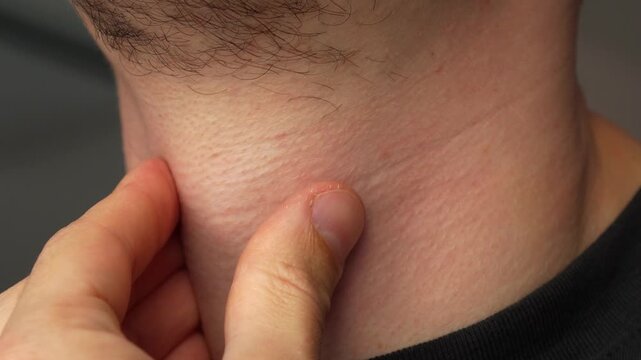 Sore throat.
Inflamed tonsils during tonsillitis.
Symptoms of flu and colds in men.
An adult man suffers from a sore throat.
Sore throat during a pandemic.
Medicine, treatment, cold