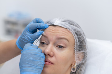 Botulinum Therapy Session for Wrinkle Reduction in a Modern Clinical Setting