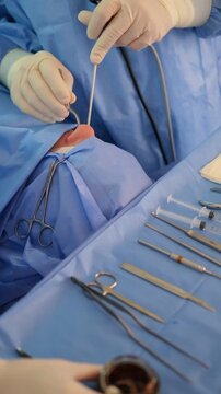 Medical professionals conduct a precise surgical procedure on a patient's nose, utilizing an array of instruments for optimal accuracy and minimal invasiveness. Vertical video
