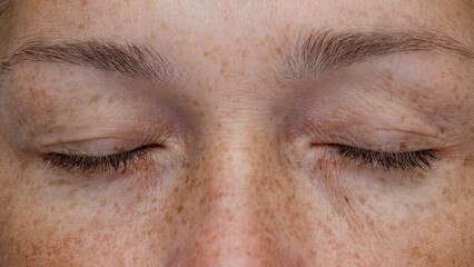 Close-up of closed eyes of a middle-aged woman with hooded eyelids and freckles