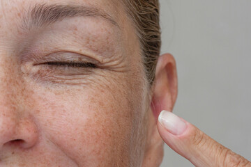 Obraz premium Close up cropped view of a middle aged smiling woman pointing at wrinkles around her closed eye