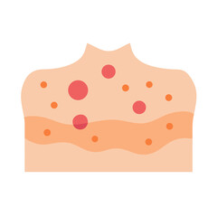 Illustration of skin with visible skin condition or allergy