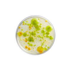 Microscopic View of Bacteria Colonies in Petri Dish, Scientific Research, Microbiology