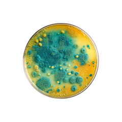 Microscopic View of Bacterial Colonies on Agar Plate Teal and Yellow Growth