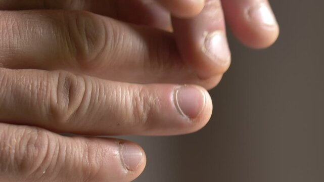 Close-up of a middle-aged man hands highlighting dry skin