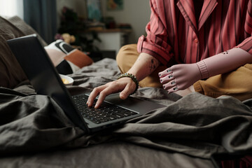 Young adult Caucasian woman with prosthetic hand sitting on bed using laptop, focusing on screen,...