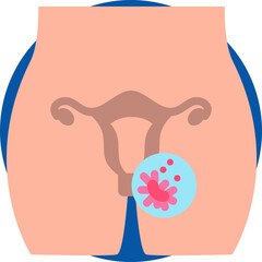 Ovarian cancer icon for cancer diagnosis, website, application, printing, document, poster design, etc