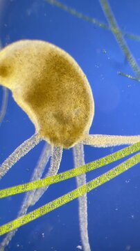 Hydra under the microscope at 40x Magnification
