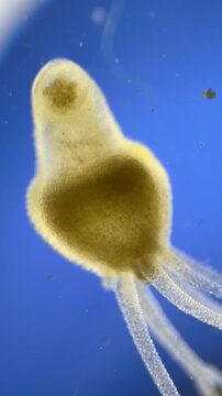 Hydra under the microscope at 40x Magnification