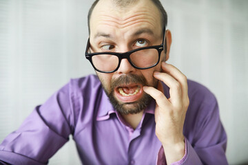 A cross-eyed bearded man is looking into the frame. Eye disease. The concept of an inexperienced...